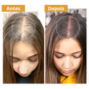 Biotim Serum Anti-Queda e Crescimento Capilar |OFERTA COMPRE 2 LEVE 3| + Frete Grátis