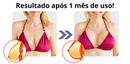 UltraUp® Sutiã Elétrico Massageador
