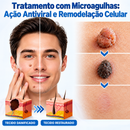 Adesivos Hiskin® Original - Removedor Invisível de Verrugas e Sinais na Pele |COMPRE 1 LEVE 3|