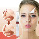 Removedor de Verrugas WipeOff™ |COMPRE 1 LEVE 2|