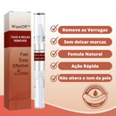 Removedor de Verrugas WipeOff™ |COMPRE 1 LEVE 3| + Frete Grátis (Oferta de Black Friday)